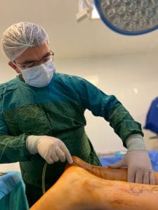 denizli estetik doktoru hüseyin zeybek