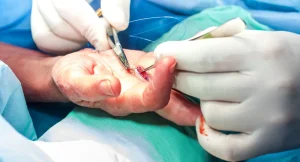 el cerrahisi Was ist Handchirurgie? Grundlegende Informationen und Methoden