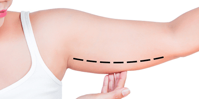 estetik ameliyatlarin tarihcesi ve gelisimi 2 History and Development of Aesthetic Surgeries